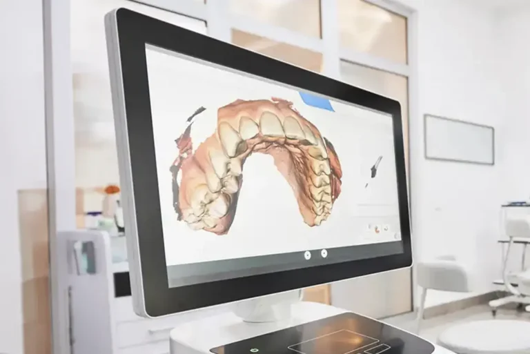 Digital scanner at Tysons Dental Spa in Vienna, VA.